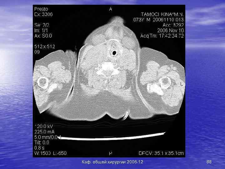 Каф. общей хирургии 2006 -12 88 