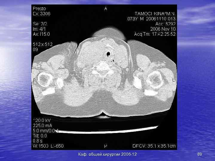 Каф. общей хирургии 2006 -12 89 