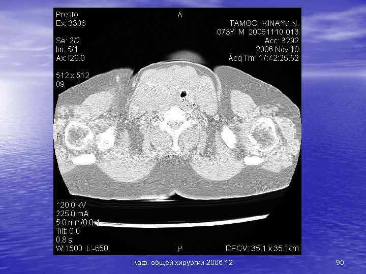 Каф. общей хирургии 2006 -12 90 