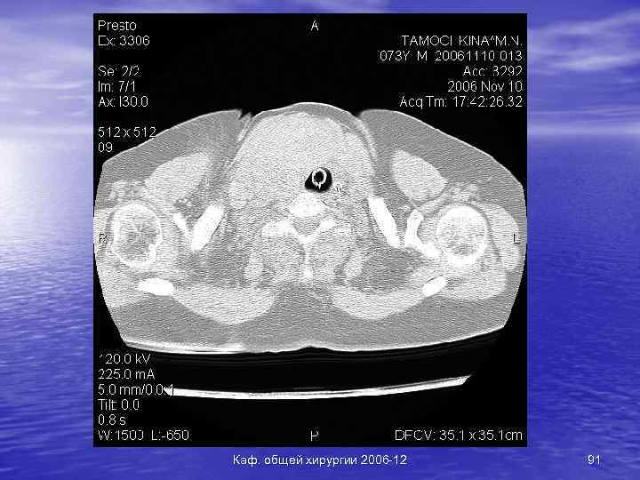 Каф. общей хирургии 2006 -12 91 