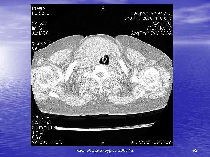 Каф. общей хирургии 2006 -12 92 
