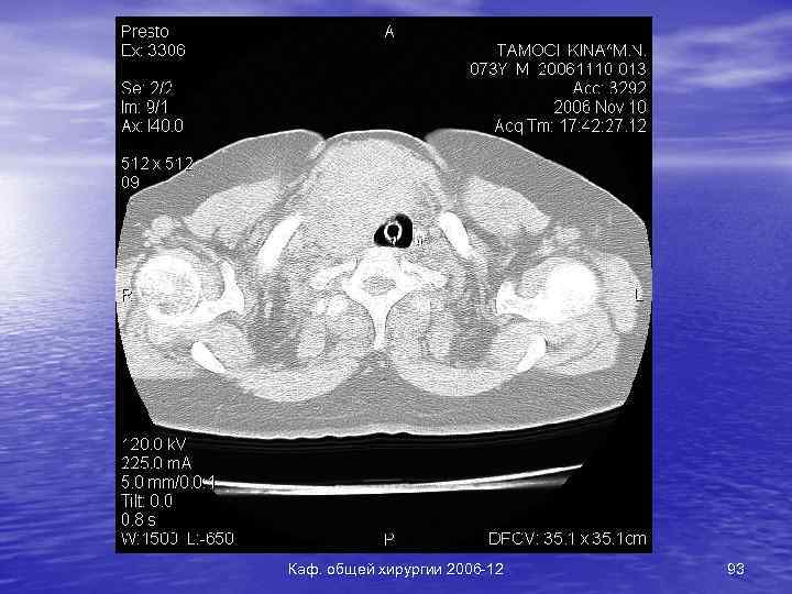 Каф. общей хирургии 2006 -12 93 