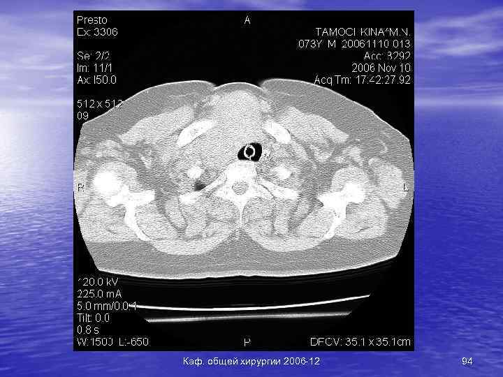 Каф. общей хирургии 2006 -12 94 