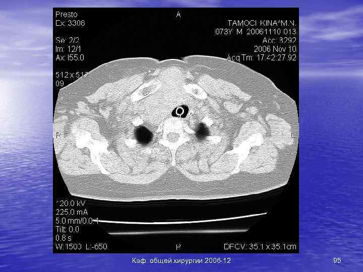 Каф. общей хирургии 2006 -12 95 