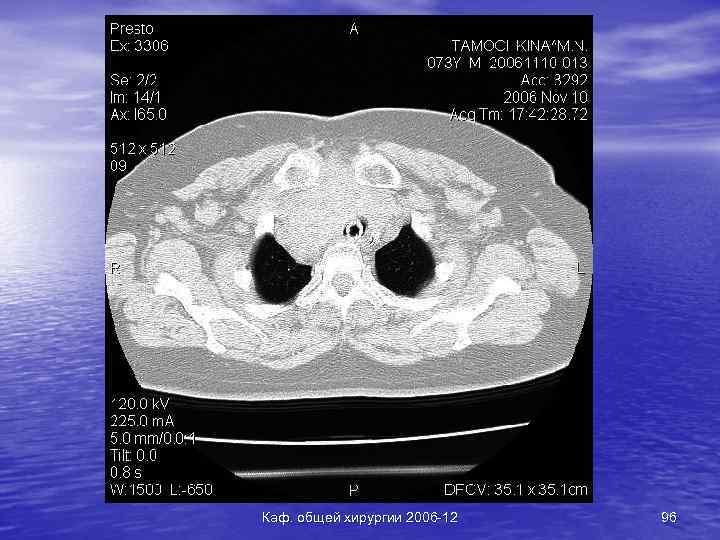 Каф. общей хирургии 2006 -12 96 