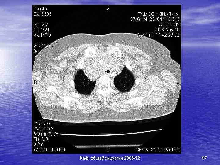 Каф. общей хирургии 2006 -12 97 