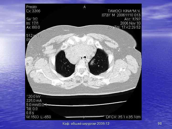 Каф. общей хирургии 2006 -12 98 