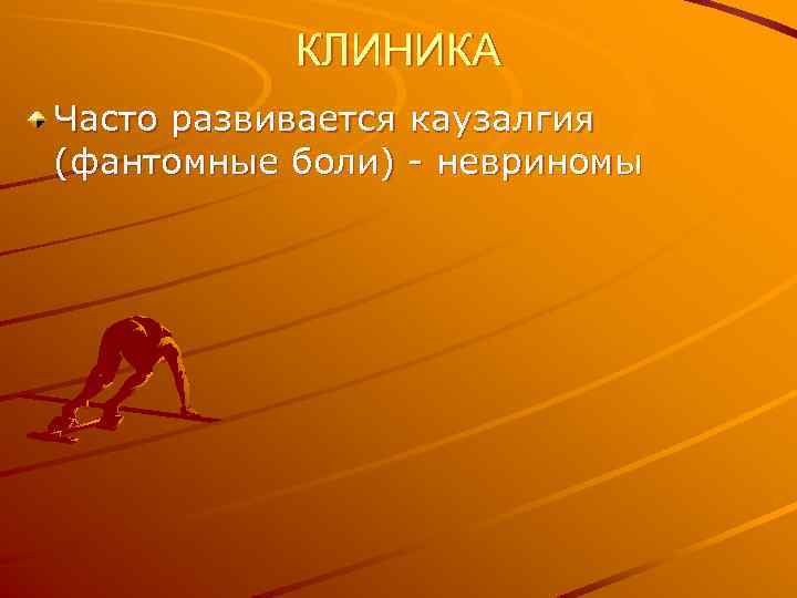 КЛИНИКА Часто развивается каузалгия (фантомные боли) - невриномы 