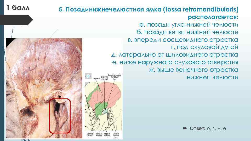 1 балл 5. Позадинижнечелюстная ямка (fossa retromandibularis) располагается: а. позади угла нижней челюсти б.
