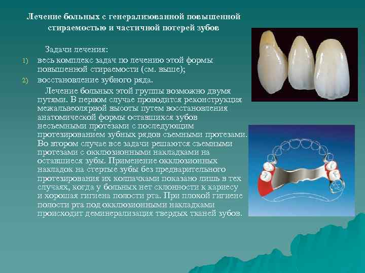 Лечение больных с генерализованной повышенной стираемостью и частичной потерей зубов 1) 2) Задачи лечения: