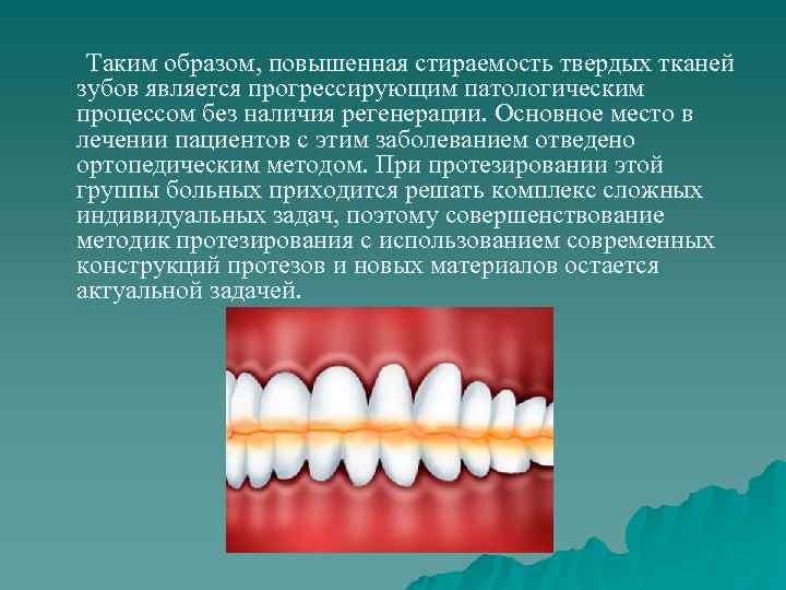 Таким образом, повышенная стираемость твердых тканей зубов является прогрессирующим патологическим процессом без наличия регенерации.