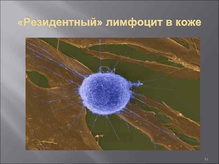  «Резидентный» лимфоцит в коже 31 