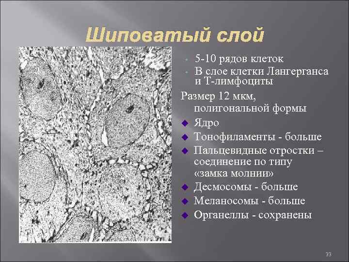 Шиповатый слой 5 -10 рядов клеток • В слое клетки Лангерганса и Т-лимфоциты Размер