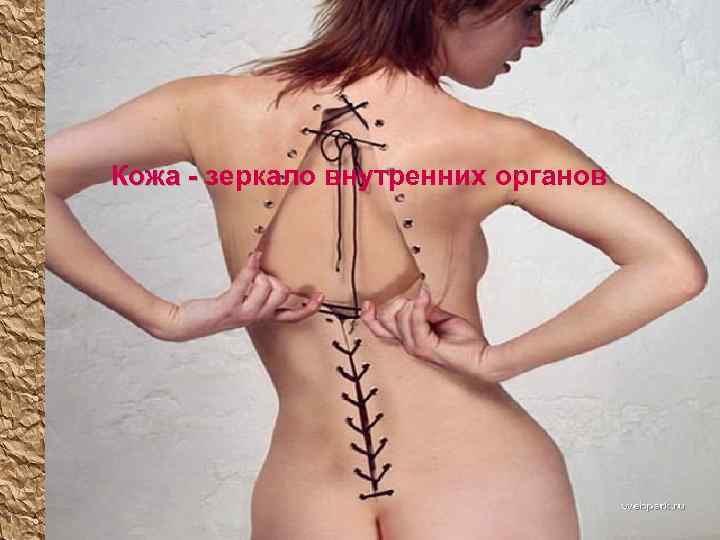 Кожа - зеркало внутренних органов 65 