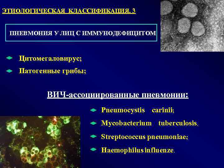 ЭТИОЛОГИЧЕСКАЯ КЛАССИФИКАЦИЯ. 3 ПНЕВМОНИЯ У ЛИЦ С ИММУНОДЕФИЦИТОМ Цитомегаловирус; Патогенные грибы; ВИЧ-ассоциированные пневмонии: Pneumocystis
