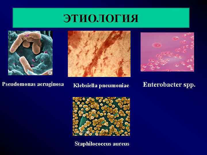 ЭТИОЛОГИЯ Pseudomonas aeruginosa Klebsiella pneumoniae Staphilococcus aureus Enterobacter spp. 
