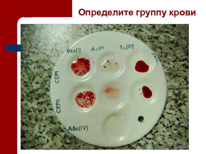 Определите группу крови 