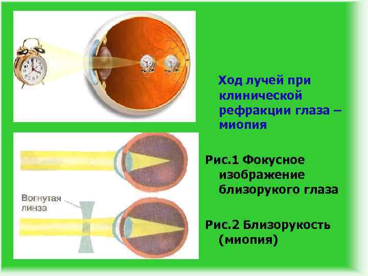 Какая из схем хода лучей в глазу человека соответствует