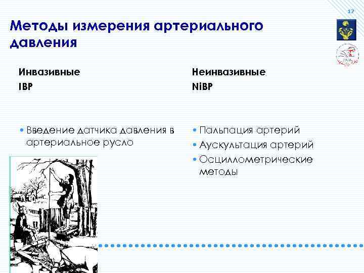 17 Методы измерения артериального давления Инвазивные IBP Неинвазивные Ni. BP • Введение датчика давления