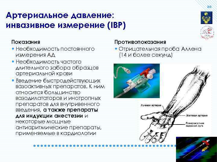 26 Артериальное давление: инвазивное измерение (IBP) Показания • Необходимость постоянного измерения АД • Необходимость