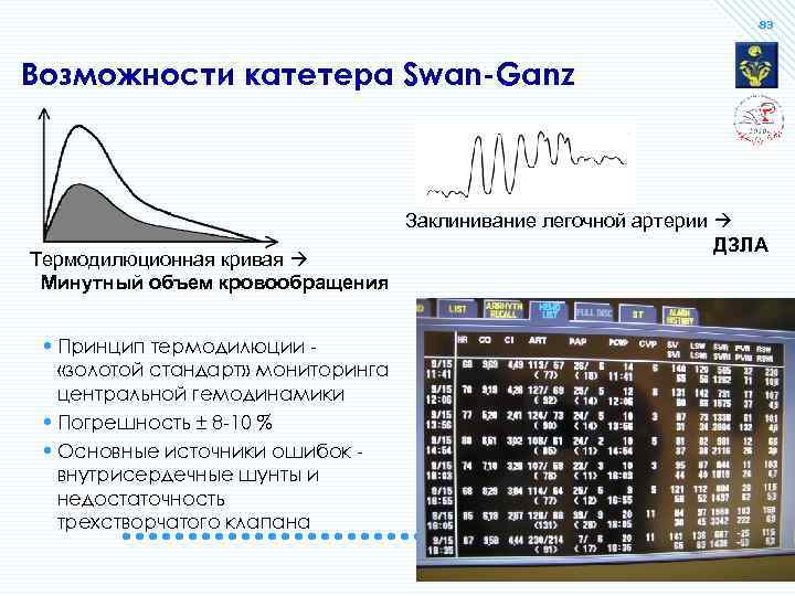 83 Возможности катетера Swan-Ganz Термодилюционная кривая Минутный объем кровообращения • Принцип термодилюции «золотой стандарт»