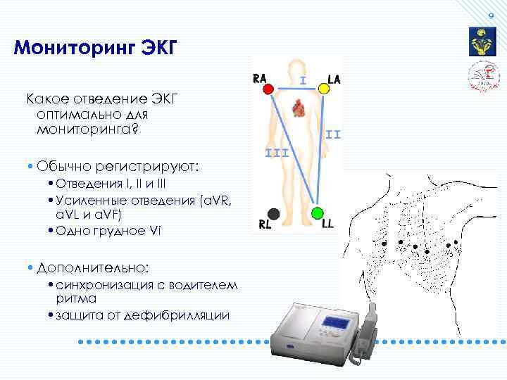 9 Мониторинг ЭКГ Какое отведение ЭКГ оптимально для мониторинга? • Обычно регистрируют: • Отведения