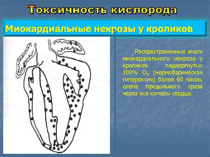 Миокардиальные некрозы у кроликов Распространенные очаги миокардиального некроза у кроликов подвергнутых 100% O 2