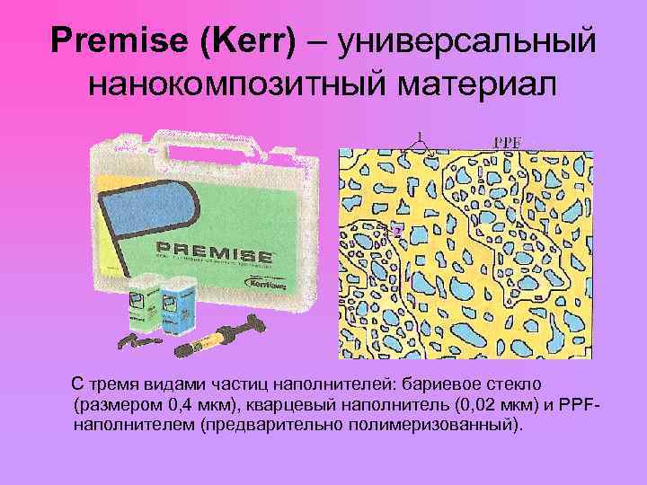 Premise (Kerr) – универсальный нанокомпозитный материал С тремя видами частиц наполнителей: бариевое стекло (размером