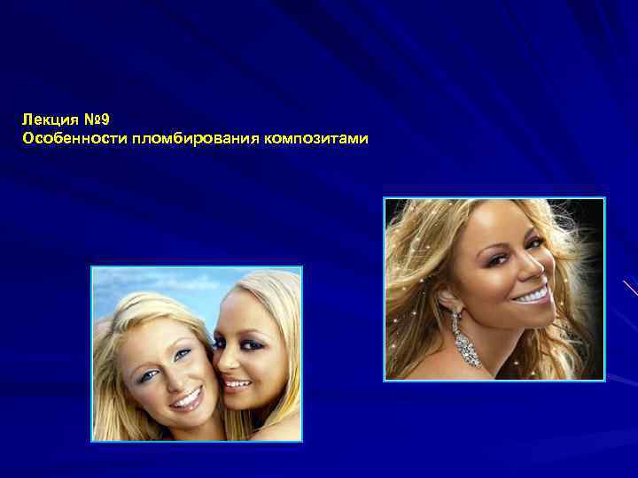 Лекция № 9 Особенности пломбирования композитами 