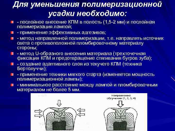 Для уменьшения полимеризационной усадки необходимо: - послойное внесение КПМ в полость (1, 5 -2