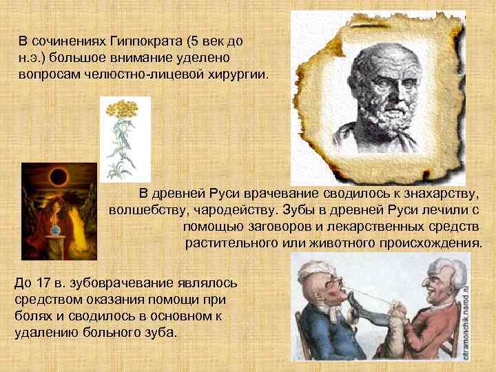 В сочинениях Гиппократа (5 век до н. э. ) большое внимание уделено вопросам челюстно-лицевой