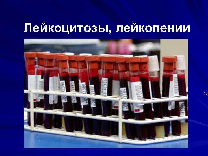 Лейкоцитозы, лейкопении 