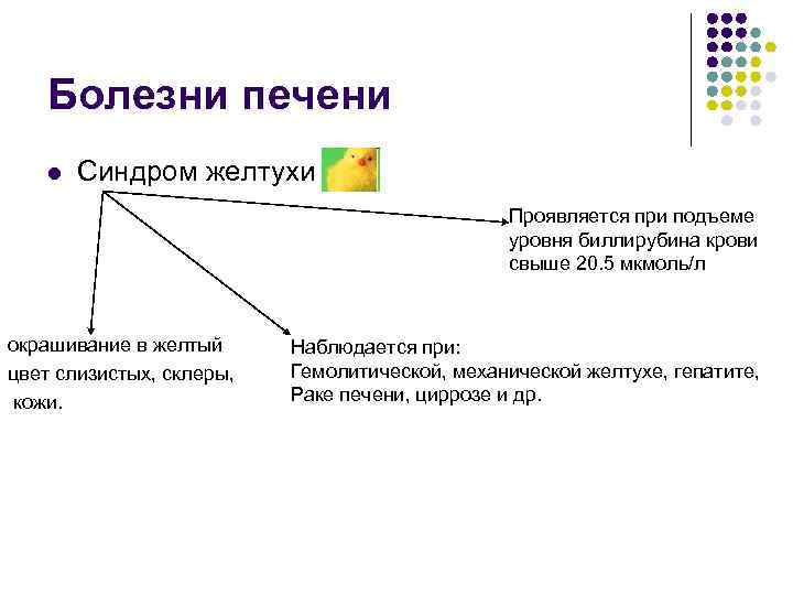 Болезни печени l Синдром желтухи Проявляется при подъеме уровня биллирубина крови свыше 20. 5