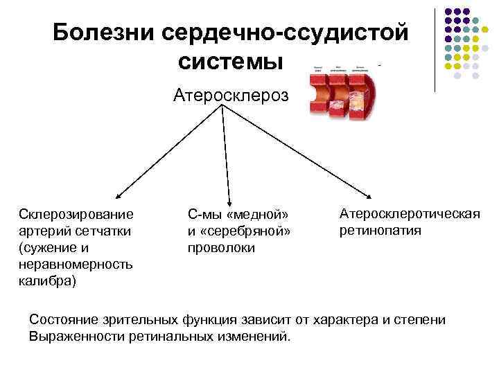 Болезни сердечно-ссудистой системы Атеросклероз Склерозирование артерий сетчатки (сужение и неравномерность калибра) С-мы «медной» и