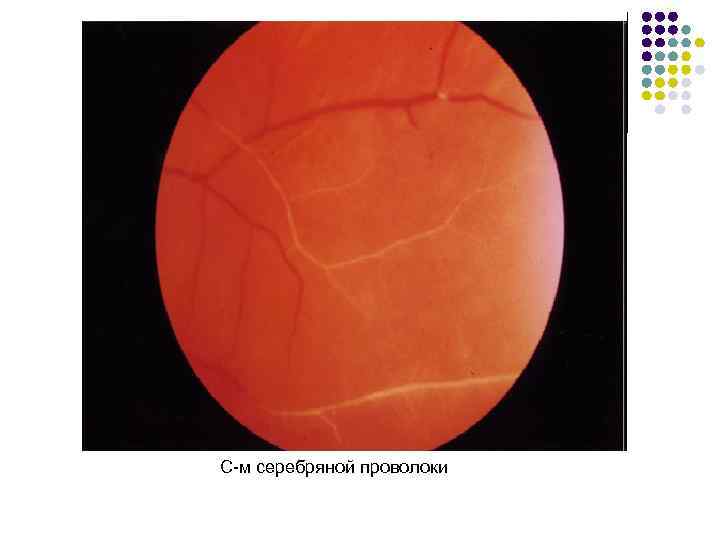 С-м серебряной проволоки 