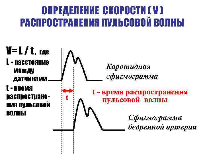 ОПРЕДЕЛЕНИЕ СКОРОСТИ ( V ) РАСПРОСТРАНЕНИЯ ПУЛЬСОВОЙ ВОЛНЫ V= L / t , где
