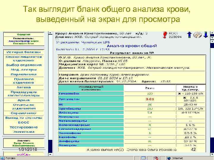 Так выглядит бланк общего анализа крови, выведенный на экран для просмотра 1/31/2018 42 