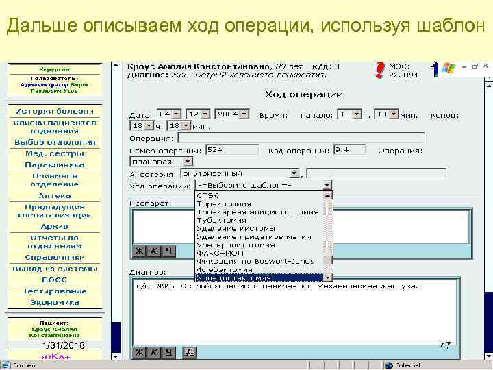 Дальше описываем ход операции, используя шаблон 1/31/2018 47 