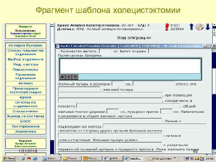 Фрагмент шаблона холецистэктомии 1/31/2018 48 