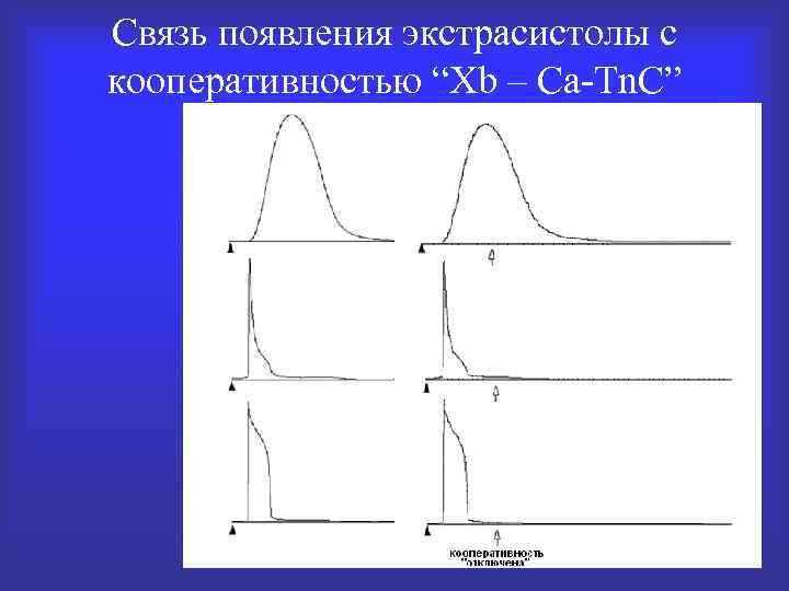 Связь появления экстрасистолы с кооперативностью “Xb – Ca-Tn. C” 