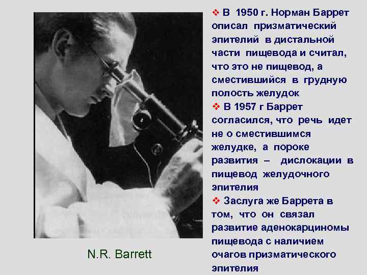 v В 1950 г. Норман Баррет N. R. Barrett описал призматический эпителий в дистальной