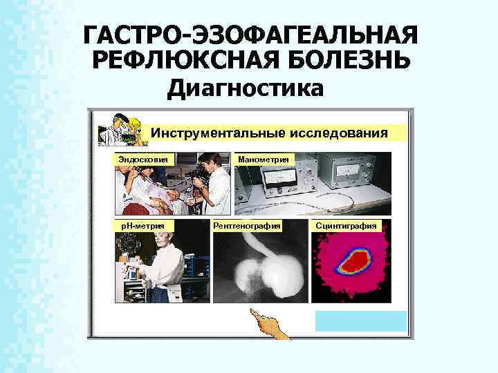 ГАСТРО-ЭЗОФАГЕАЛЬНАЯ РЕФЛЮКСНАЯ БОЛЕЗНЬ Диагностика Инструментальные исследования Эндоскопия р. Н-метрия Манометрия Рентгенография Сцинтиграфия 7 