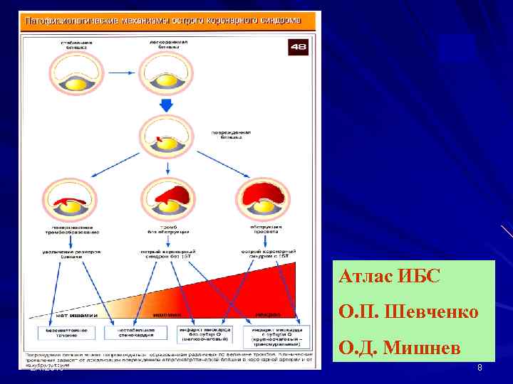 Атлас ИБС О. П. Шевченко О. Д. Мишнев 2/1/2018 8 