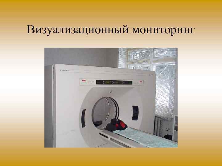 Визуализационный мониторинг 