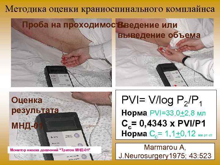 Методика оценки краниоспинального комплайнса Проба на проходимость Введение или выведение объема Оценка результата PVI=