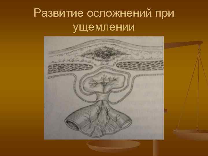 Развитие осложнений при ущемлении 