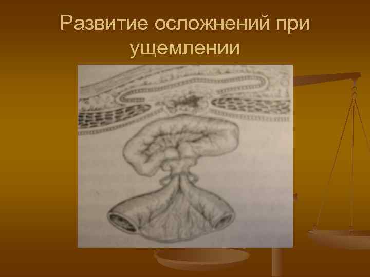 Развитие осложнений при ущемлении 