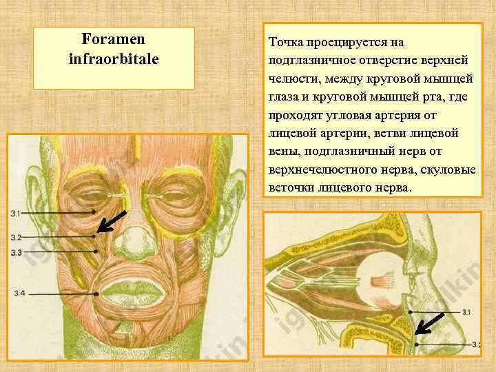 Foramen infraorbitale Точка проецируется на подглазничное отверстие верхней челюсти, между круговой мышцей глаза и