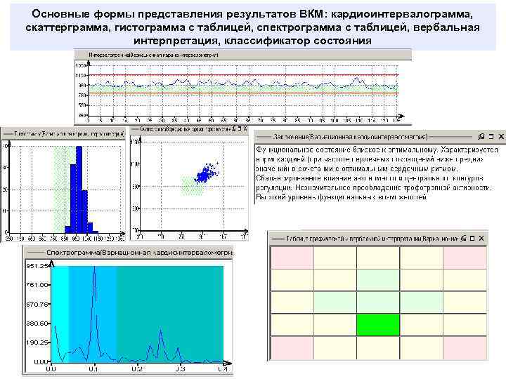 Основные формы представления результатов ВКМ: кардиоинтервалограмма, скаттерграмма, гистограмма с таблицей, спектрограмма с таблицей, вербальная