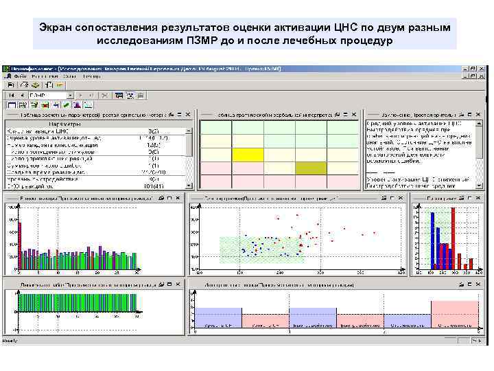 Экран сопоставления результатов оценки активации ЦНС по двум разным исследованиям ПЗМР до и после
